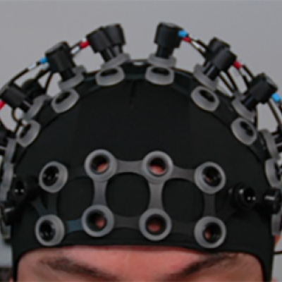 Functional Near-Infrared Spectroscopy (fNIRS)